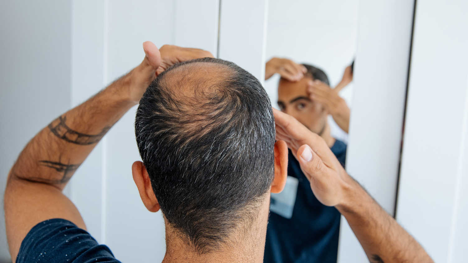 Sheffield Mice Study: 2dDR for Hair Growth in Androgenic Alopecia