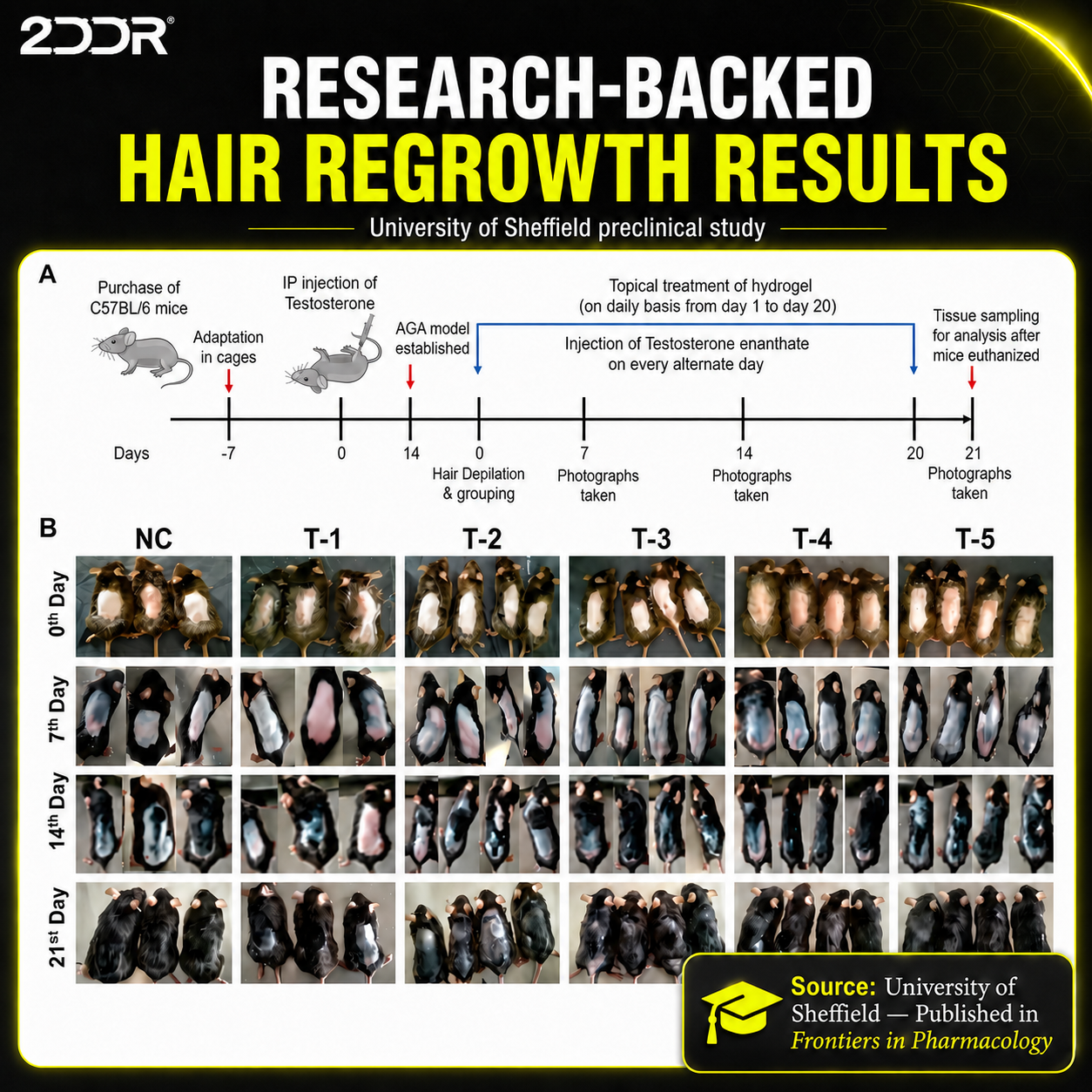 Advanced Hair Formula | 3 Month Supply | Free Derma Roller + Free US Shipping