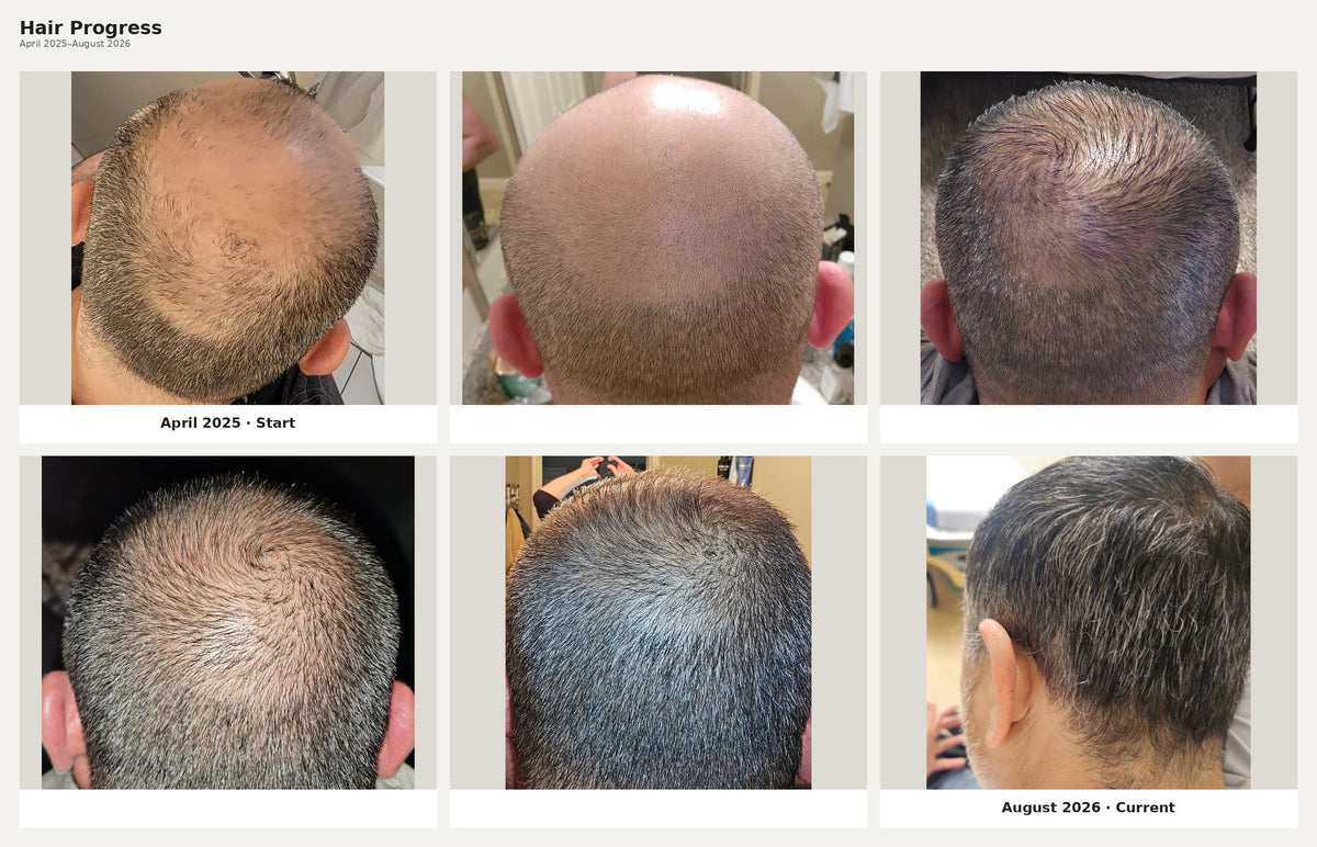 Advanced Hair Formula