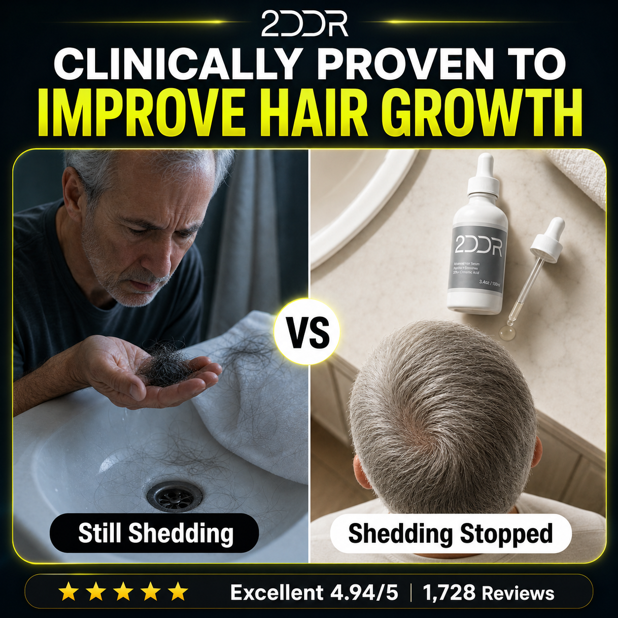 Advanced Hair Formula | 3 Month Supply | Free Derma Roller + Free US Shipping