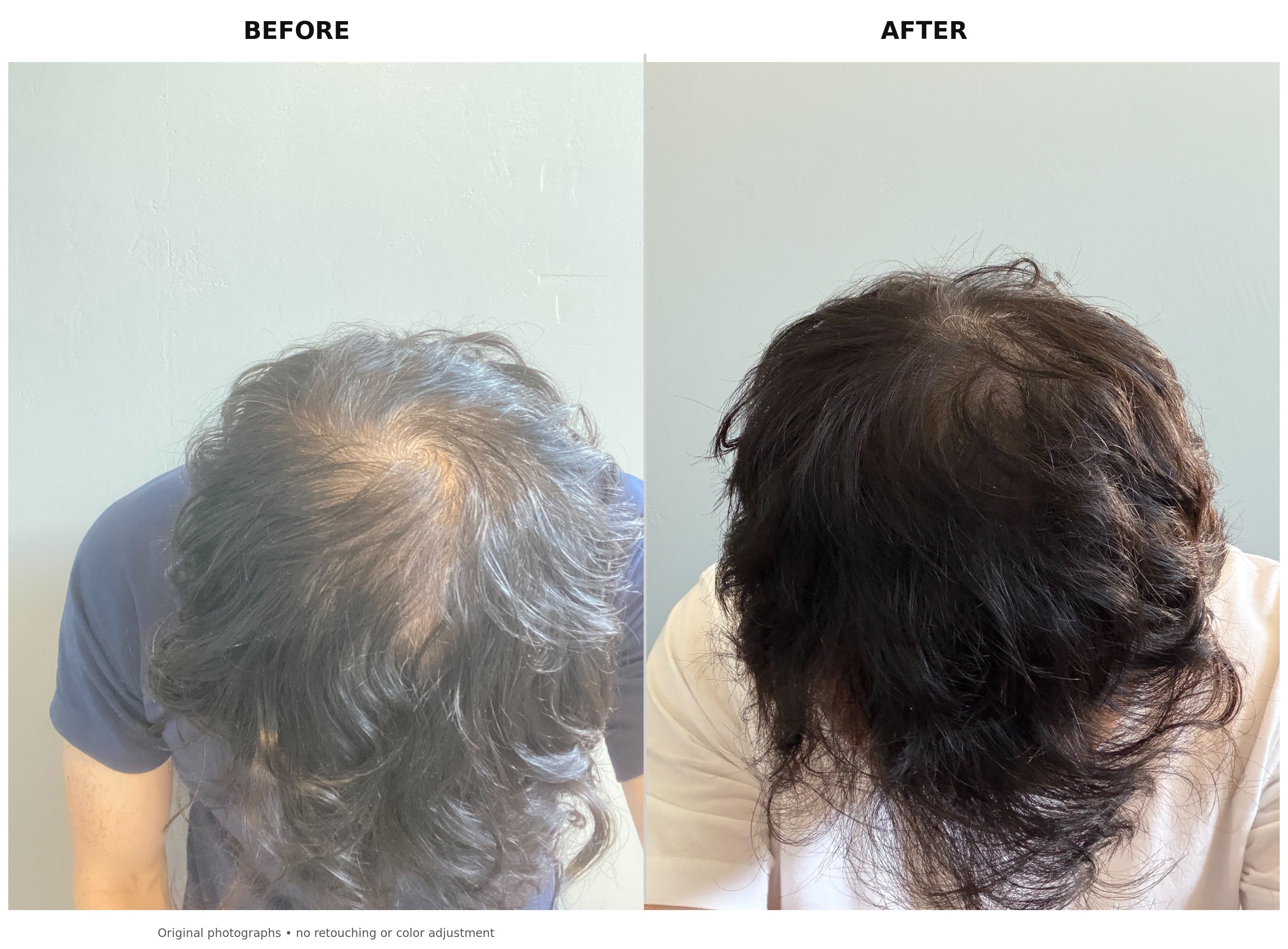 Advanced Hair Formula