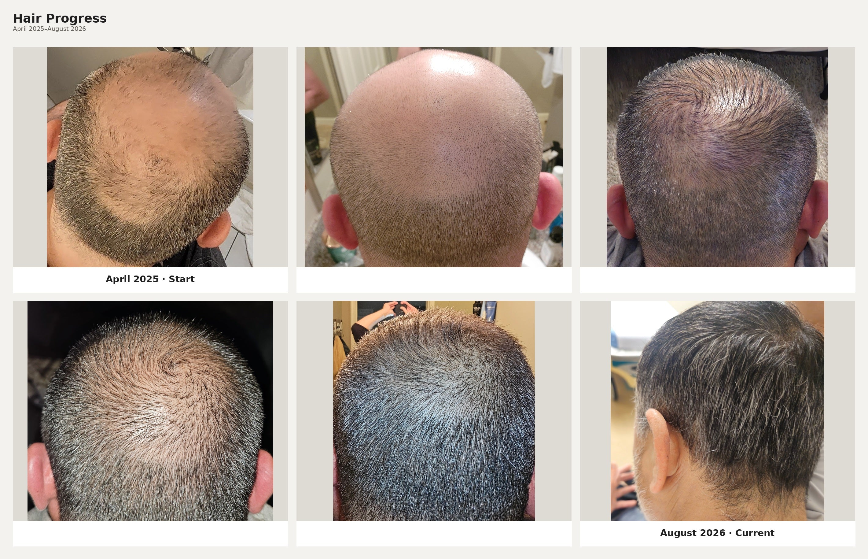 Advanced Hair Formula