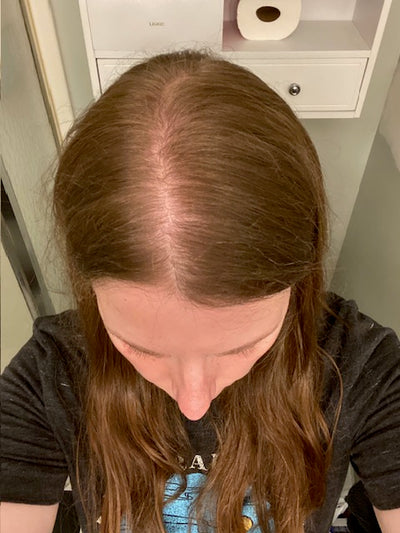 Tess B., Day 180